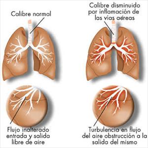 How To Improve Sinu - Sinusitis Dizziness: What, Why, How To Avoid