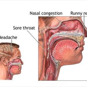 Sinusitis Home Remedy - Sinus Infection Sufferers Can Treat It With Great, Natural, Home Remedies.