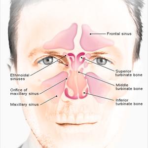 Dry Smelly Nasal Mucous Treatment - Sinus Problems? No Problem At All