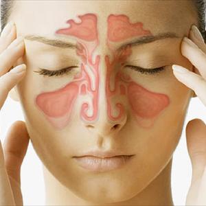 Sinus Cavity Diagram - Deviated Nasal Septum: More Than Mere Appearances