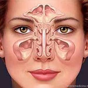 What Happens After Sinus Surgery - Fungal Sinusitis: 2 Guaranteed Medical Coding Formulas That Work