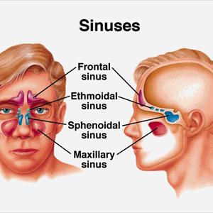 Can Alcohol Irritate Sinus 