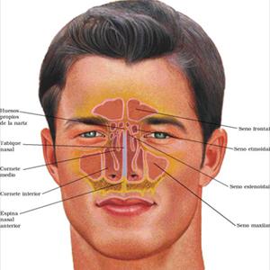 Headache Under Eyebrow - Info On Sinusitis Food