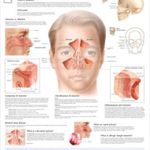 Green Mucous From Nasal Passage - Say Goodbye To Sinus Headache